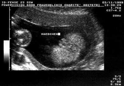 Bild zu Altes Outingbild Mädchen 23+2 - Forum für Oktober - Mamis
