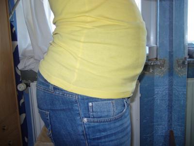 Bild zu guckt euch mal die plautze an!!!! - Forum für Oktober - Mamis