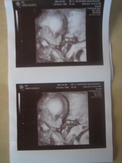 Bild zu PREMIERE: ein bild von meinem prinz und das auch noch in 3d - Forum für Oktober - Mamis