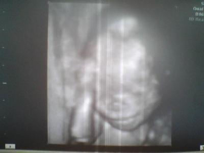 Bild zu Zurück vom FA!!! - Forum für Oktober - Mamis