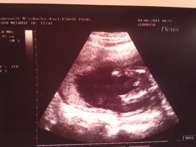 Bild zu Eindeutig oder ? - Forum für Oktober - Mamis