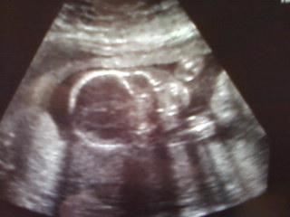 Bild zu VU in der 21.SSW und HALBZEIT!!!! - Forum für Oktober - Mamis