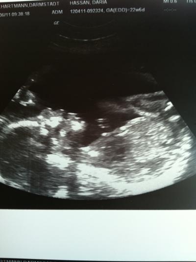 Bild zu Heute beim FA - Forum für Oktober - Mamis