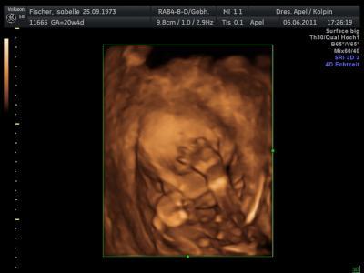 Bild zu zurück vom FA - Forum für Oktober - Mamis