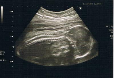 Bild zu VU + Foto - Forum für Oktober - Mamis