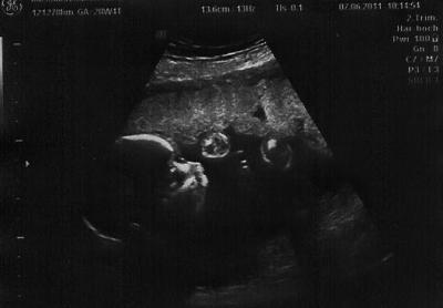 Bild zu Gerade von der Vu rein... - Forum für Oktober - Mamis