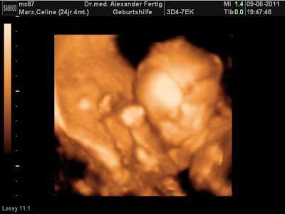 Bild zu Mein Bericht v. gestrigen Gyn.-Termin! - Forum für Oktober - Mamis