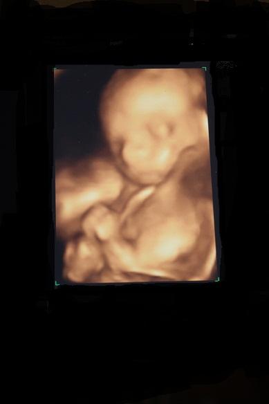 Bild zu Unverhofft - Forum für Oktober - Mamis