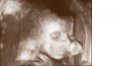 Bild zu wir bekommen einen Daumenlutscher ;-) - Forum für Oktober - Mamis