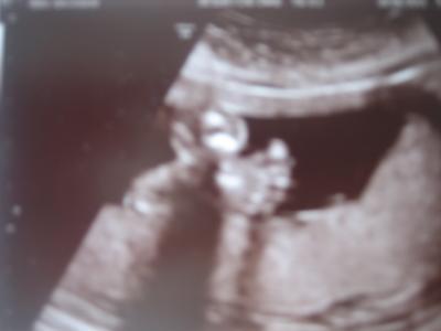 Bild zu mooorrrgäääään und bericht vom FU gestern - Forum für Oktober - Mamis