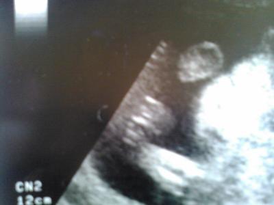 Bild zu Gibt es hier Ultraschallexperten..... - Forum für Oktober - Mamis