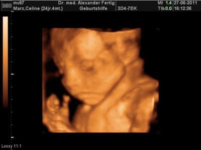 Bild zu Zurück vom Gyn. Besuch =) - Forum für Oktober - Mamis