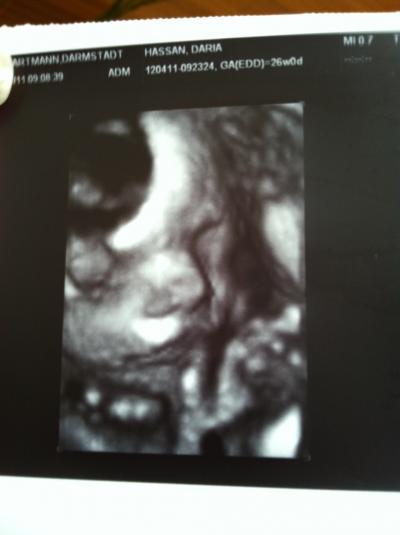 Bild zu Zurück vom FA und in der 27sten - Forum für Oktober - Mamis