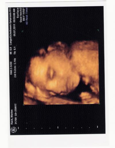 Bild zu zurück von vu und zuckertest und 3d^^ - Forum für Oktober - Mamis
