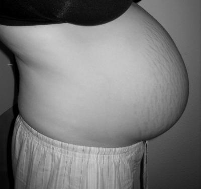 Bild zu ich traue mich euch meinen bauch alias kraterlandschaft zu zeigen - Forum für Oktober - Mamis