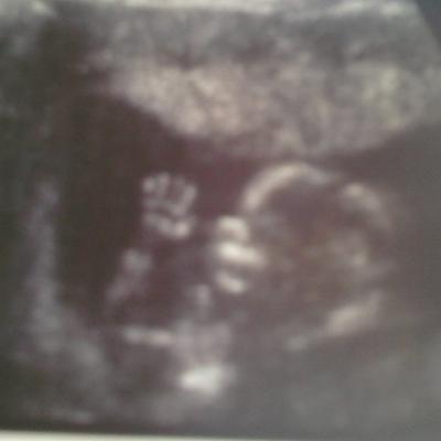 Bild zu euer schönstes ultraschall bild - bis jetzt - Forum für Oktober - Mamis