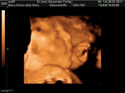 Bild zu na prima... - Forum für Oktober - Mamis