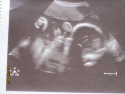 Bild zu wieder da von VU :-) - Forum für Oktober - Mamis