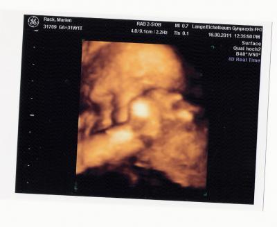 Bild zu sooo endlich wieder da, hat ja ewig gedauert heute... vu und us auswertung - Forum für Oktober - Mamis
