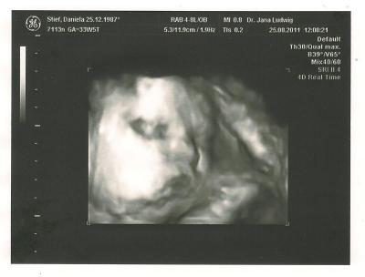 Bild zu Hab mal die bilder gescennt - Forum für Oktober - Mamis
