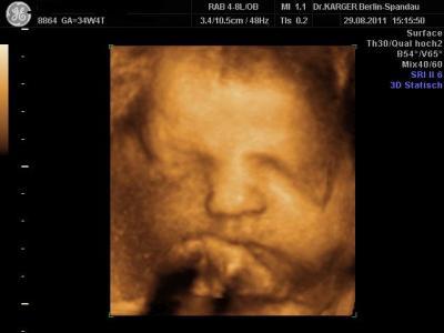 Bild zu Zurück von VU und nachdenklich :( - Forum für Oktober - Mamis