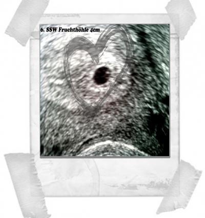 Bild zu Erster FA- Besuch - Mit Bild - Forum für Oktober - Mamis