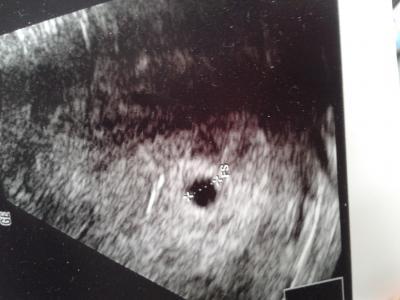 Bild zu Auch mal bild zeigen will - Forum für Oktober - Mamis