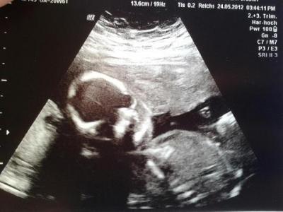 Bild zu 100% Outing vom FA!!! Und Bild :) - Forum für Oktober - Mamis