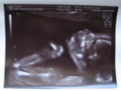 Bild zu Wieder da vom FA! :-) - Forum für Oktober - Mamis