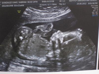 Bild zu Baby-TV Bericht 20+2 - Forum für Oktober - Mamis