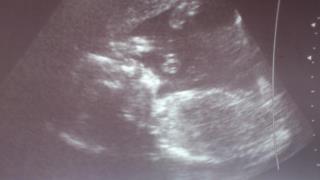 Bild zu FA termin mit outing - Forum für Oktober - Mamis