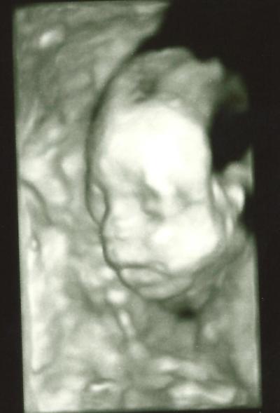 Bild zu Zurück von Feindiagnostik mit schönstem Baby Foto!!!! - Forum für Oktober - Mamis
