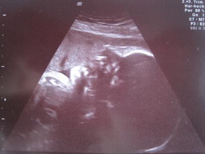 Bild zu Heute VU mit letztem Ultraschall! - Forum für Oktober - Mamis