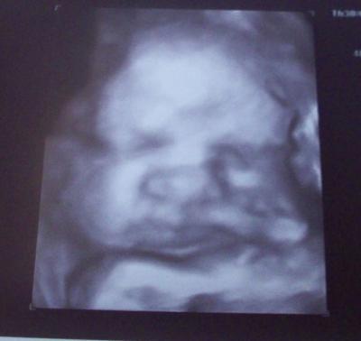 Bild zu Gutes Geburtsplanungsgespräch - Forum für Oktober - Mamis