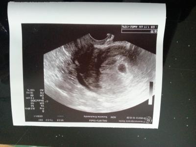 Bild zu Ich stell mich dann auch mal vor... mit Foto *seht ihr was?* - Forum für Oktober - Mamis
