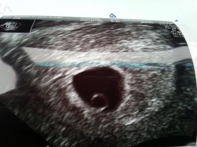 Bild zu Endlich hab ich das erste Bild... - Forum für Oktober - Mamis