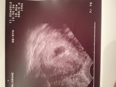 Bild zu Hab das Herzchen schlagen sehen! =) - Forum für Oktober - Mamis