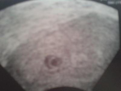 Bild zu hilfe.... - Forum für Oktober - Mamis
