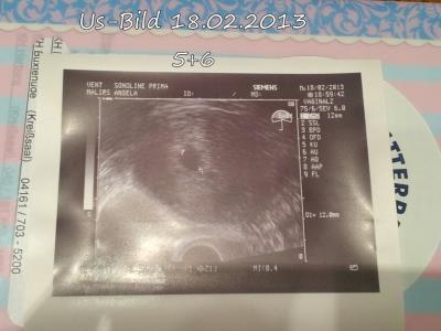 Bild zu Mein FA Besuch gestern! - Forum für Oktober - Mamis