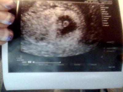 Bild zu War heut beim Frauenarzt + Bild - Forum für Oktober - Mamis