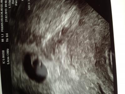 Bild zu Zurück von FA - Forum für Oktober - Mamis