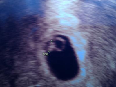 Bild zu bin auch zurück - Forum für Oktober - Mamis