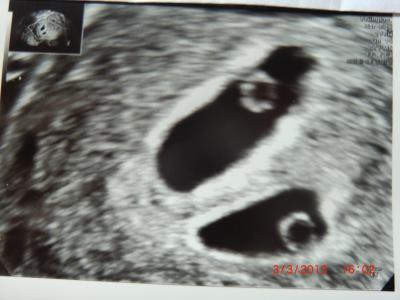 Bild zu Arztbesuch mit Folgen... - Forum für Oktober - Mamis