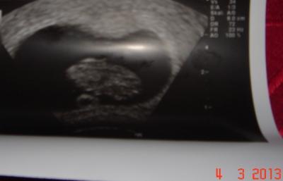 Bild zu Bildchen... - Forum für Oktober - Mamis