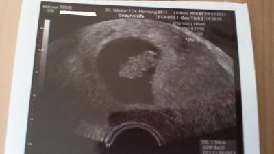 Bild zu Wieder da vom Arzt mit Bildchen - Forum für Oktober - Mamis