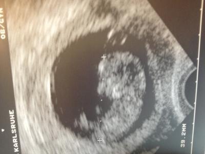 Bild zu 12. Woche und ein neues Bild! =) - Forum für Oktober - Mamis