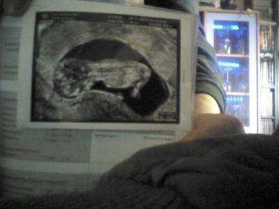 Bild zu Wieder da vom FA :-) :-) :-) - Forum für Oktober - Mamis
