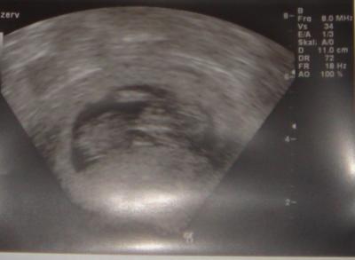 Bild zu Da bin ich wieder... - Forum für Oktober - Mamis