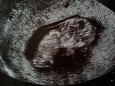 Bild zu bin auch vom fa zurück - Forum für Oktober - Mamis