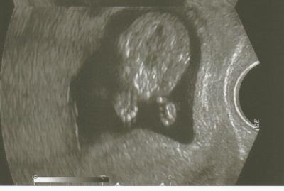 Bild zu ich habs geschafft !!! 13.ssw !!! und Fa termin (Foto) - Forum für Oktober - Mamis